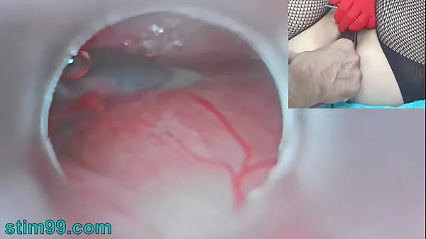 New Uncensored Japanese Insemination with Cum into Uterus and Endoscope Camera by Cervix to watch inside womb mega Tube